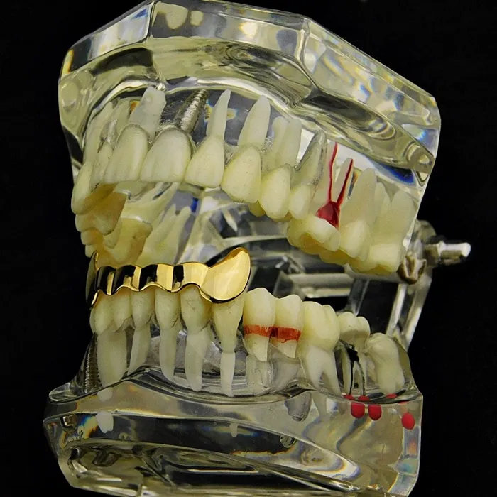14K Gold Plated Half Bottom Teeth Vampire Fangs Grillz Bling Cartel Admin PreStyled Sets