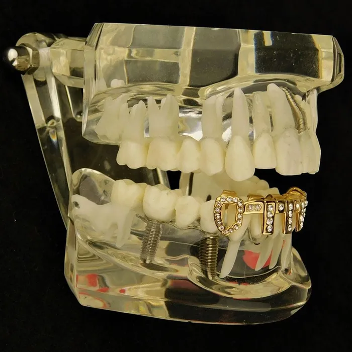 14K Gold Plated Vertical Bars Iced Bottom Teeth Grillz Bling Cartel Admin PreStyled Sets