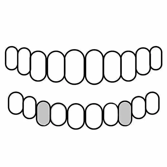 Bling Cartel Admin PreStyled Sets Real 14K White Gold Canine Teeth Caps Custom Tooth Grillz