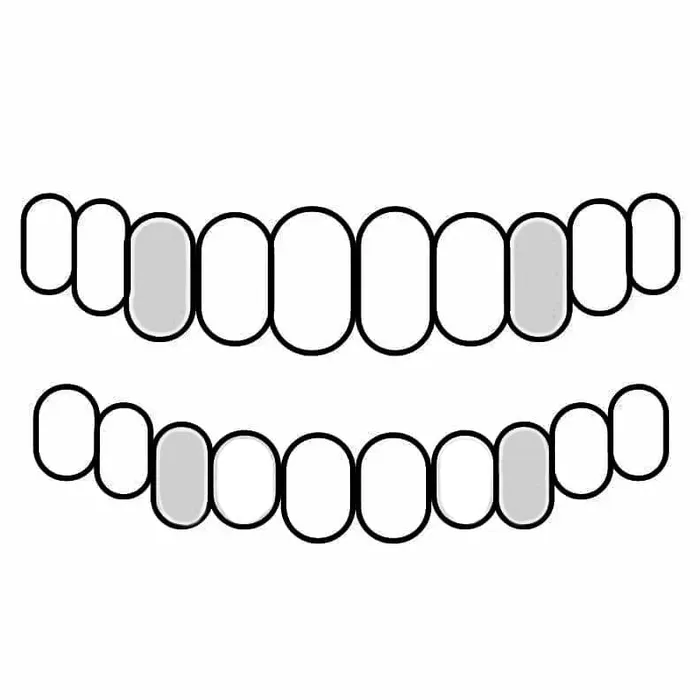 Bling Cartel Admin PreStyled Sets Real 14K White Gold Canine Teeth Caps Custom Tooth Grillz