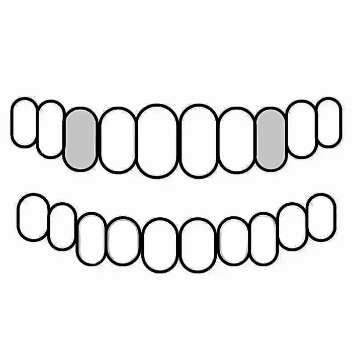 Bling Cartel Admin PreStyled Sets Real 14K White Gold Canine Teeth Caps Custom Tooth Grillz