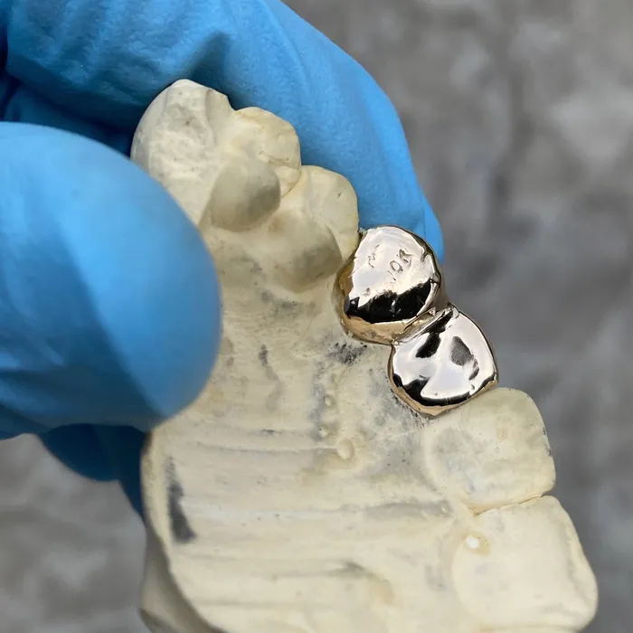 Bling Cartel Admin Rings Real 10K Gold Double Side Canine Open Face Caps Custom Grillz