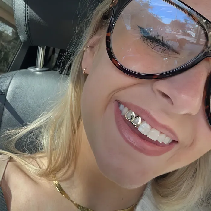Bling Cartel Admin Rings Real 10K Gold Double Side Canine Open Face Caps Custom Grillz