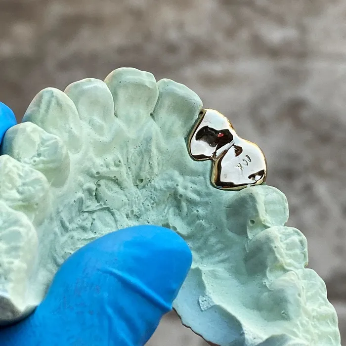 Bling Cartel Admin Rings Real 10K Gold Double Side Canine Open Face Caps Custom Grillz