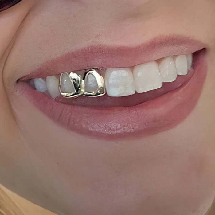 Bling Cartel Admin Rings Real 10K Gold Double Side Canine Open Face Caps Custom Grillz