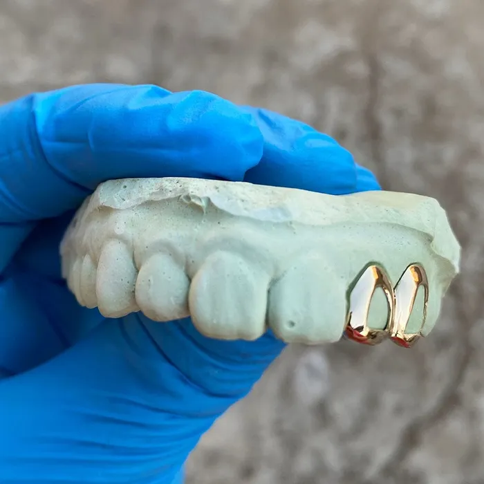 Bling Cartel Admin Rings Real 10K Gold Double Side Canine Open Face Caps Custom Grillz