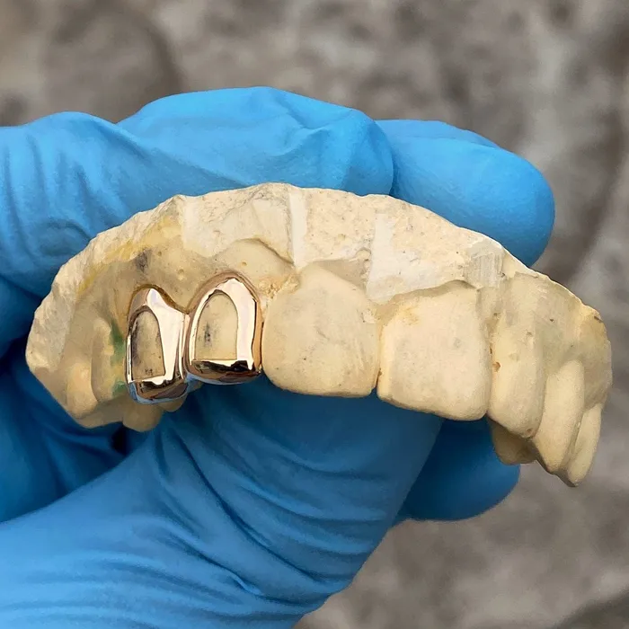 Bling Cartel Admin Rings Real 10K Gold Double Side Canine Open Face Caps Custom Grillz