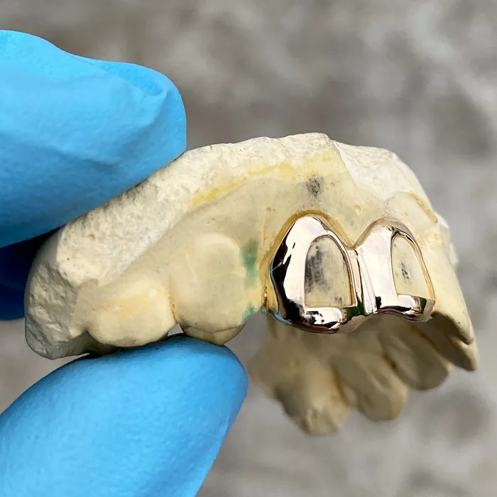 Bling Cartel Admin Rings Real 10K Gold Double Side Canine Open Face Caps Custom Grillz