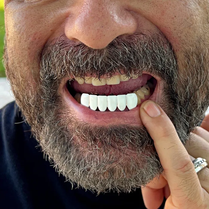 Bling Cartel Rings Real Solid 925 Sterling Silver White Enamel Bottom Six Teeth Grillz Bling Cartel Rings Real Solid 925 Sterling Silver White Enamel Bottom Six Teeth Grillz