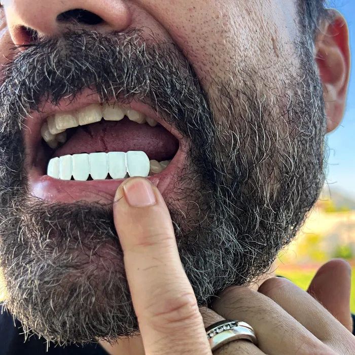 Bling Cartel Rings Real Solid 925 Sterling Silver White Enamel Bottom Six Teeth Grillz Bling Cartel Rings Real Solid 925 Sterling Silver White Enamel Bottom Six Teeth Grillz
