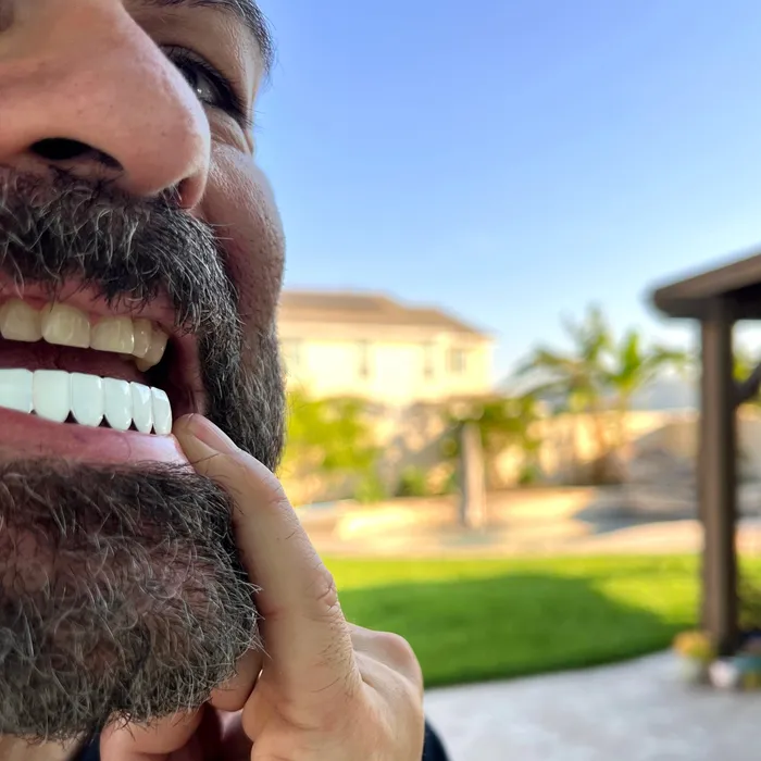 Bling Cartel Rings Real Solid 925 Sterling Silver White Enamel Bottom Six Teeth Grillz Bling Cartel Rings Real Solid 925 Sterling Silver White Enamel Bottom Six Teeth Grillz