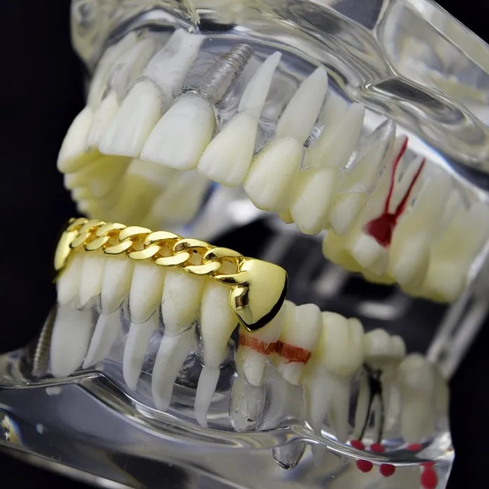 PreStyled Sets Bling Cartel Admin 14K Gold Plated Cuban Link Plain Bottom Teeth Grillz