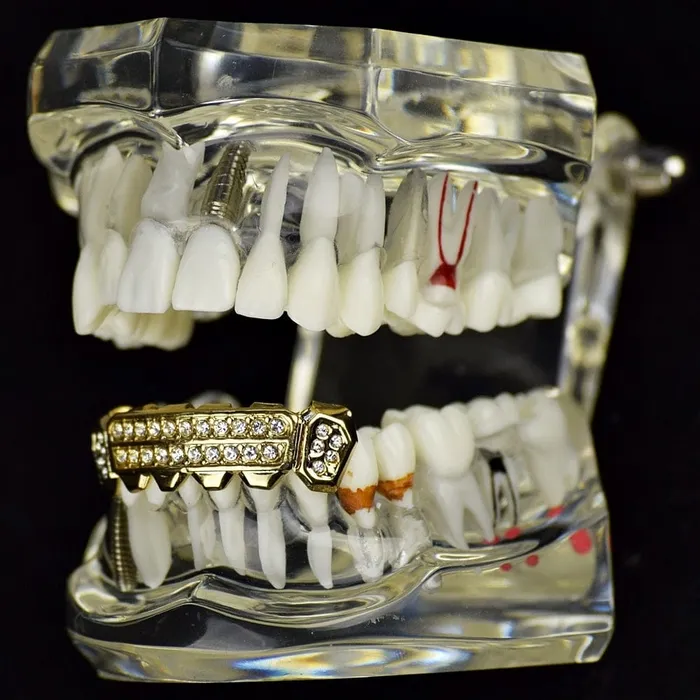 PreStyled Sets Bling Cartel Admin 14K Gold Plated TwoRow Side Bling Iced Bottom Grillz