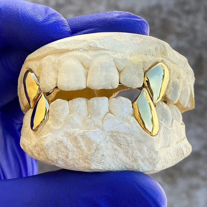 PreStyled Sets Bling Cartel Admin Real Solid 10K Gold Four Vampire Fangs wBack Bars Custom Grillz