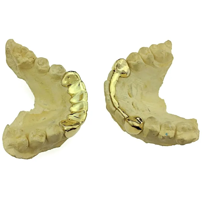 Rings Bling Cartel Admin Gold Plated over 925 Silver 2 Top Caps 6 Bottom Teeth Custom Grillz