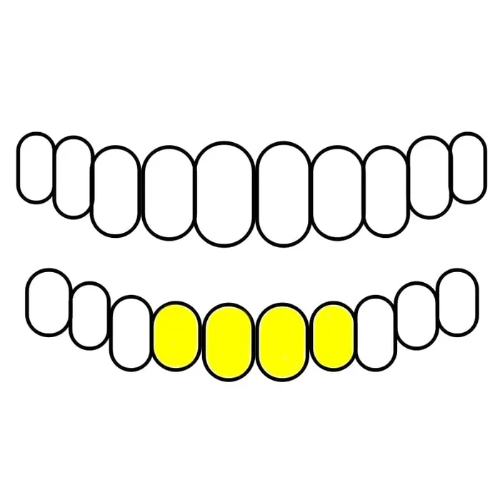 Rings Bling Cartel Admin Real 10K Gold TwoTone DiamondCut Custom Grillz