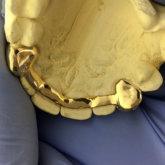 Rings Bling Cartel Admin Real 14K Gold Open Face Canine Custom Caps Grillz wBack Bar