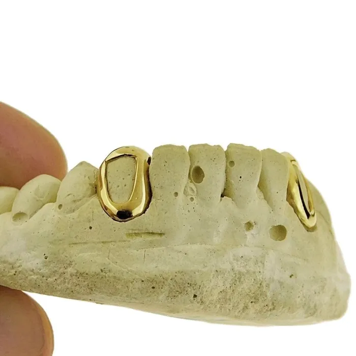 Rings Bling Cartel Admin Real 14K Gold Open Face Canine Custom Caps Grillz wBack Bar